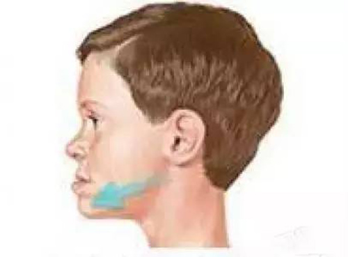 be 8 tuổi.senziny1