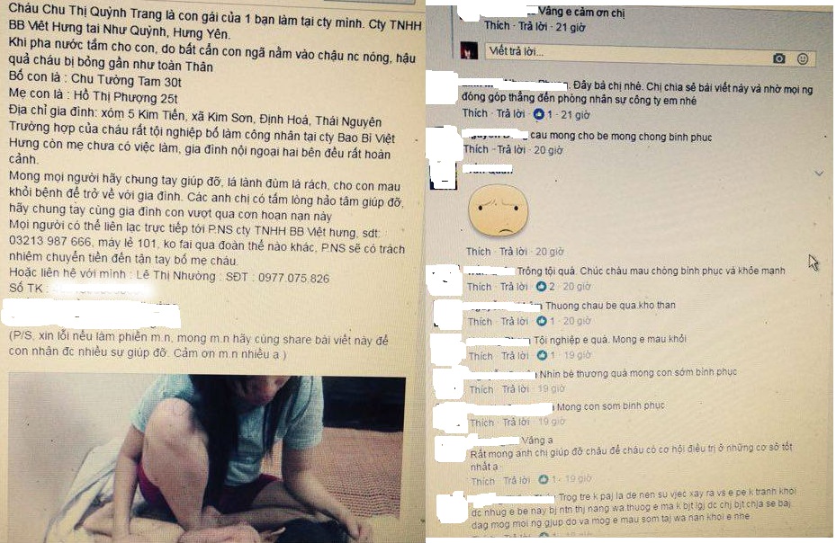 be-gai-bi-bong-senziny-2