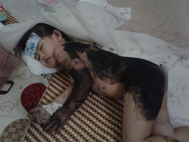 be-gai-bong-nang-senziny-1