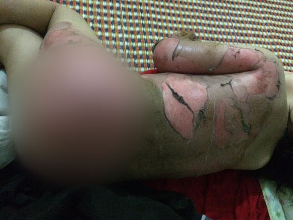 be-gai-bong-nang-senziny-2