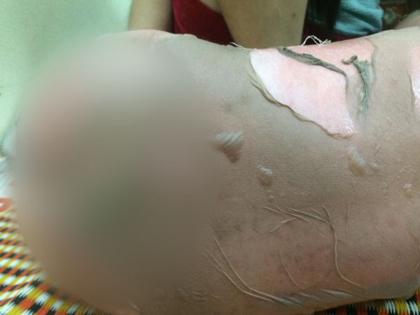 be-gai-bong-nang-senziny-4